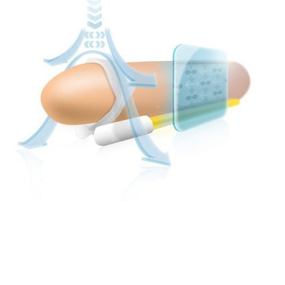 Extensor de Pénis Andropenis Mini - Aumente seu Tamanho com Conforto e Segurança